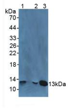 Polyclonal Antibody to Beta-2-Microglobulin (b2M)