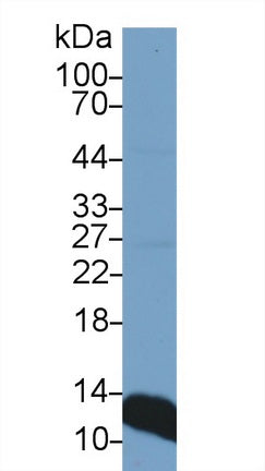 Polyclonal Antibody to Beta-2-Microglobulin (b2M)