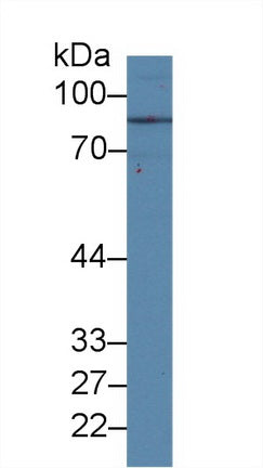 Polyclonal Antibody to Transferrin Receptor 2 (TFR2)