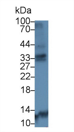 Polyclonal Antibody to Cathepsin K (CTSK)