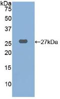 Polyclonal Antibody to Cathepsin K (CTSK)