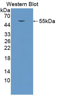 Polyclonal Antibody to Cathepsin K (CTSK)