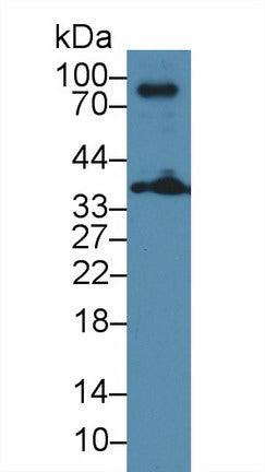 Polyclonal Antibody to Linker For Activation Of T-Cell (LAT)