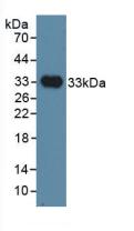 Polyclonal Antibody to Immunoglobulin superfamily, member 1 (IGSF1)