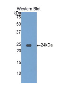 Polyclonal Antibody to Insulin Like Growth Factor Binding Protein 6 (IGFBP6)