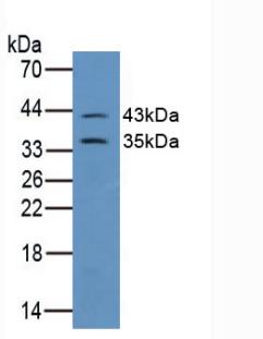 Polyclonal Antibody to Connexin 43 (CX43)