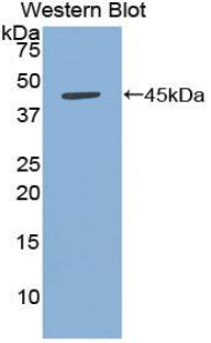 Polyclonal Antibody to B-Cell Activation Factor Receptor (BAFFR)