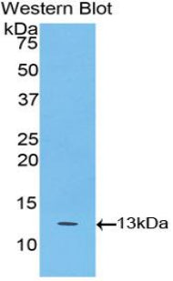 Polyclonal Antibody to B-Cell Activation Factor Receptor (BAFFR)