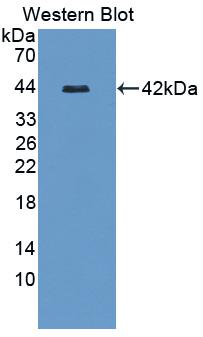 Polyclonal Antibody to Heparin Cofactor II (HCII)