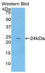 Polyclonal Antibody to Alpha-Fodrin (SPTAN1)