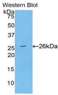 Polyclonal Antibody to Alpha-Fodrin (SPTAN1)