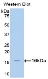 Polyclonal Antibody to Alpha-Fodrin (SPTAN1)