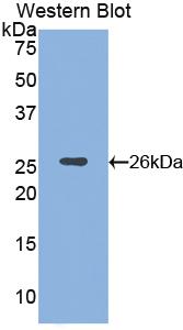 Polyclonal Antibody to Alpha-Fodrin (SPTAN1)