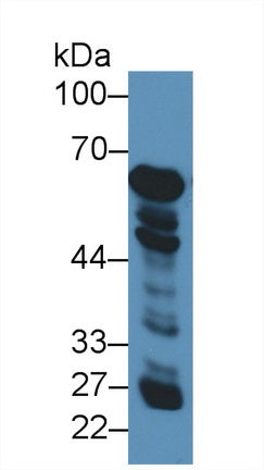 Polyclonal Antibody to Glutamate Dehydrogenase 1 (GLUD1)