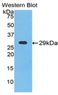 Polyclonal Antibody to Neuronal Pentraxin I (NPTX1)