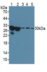 Polyclonal Antibody to Galectin 3 (GAL3)