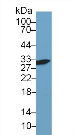 Polyclonal Antibody to Galectin 3 (GAL3)