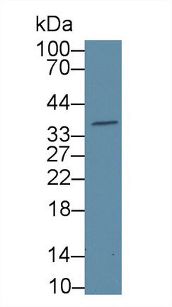 Polyclonal Antibody to Galectin 4 (GAL4)