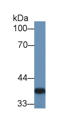 Polyclonal Antibody to Galectin 4 (GAL4)