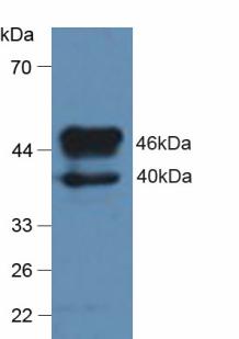 Polyclonal Antibody to Thyroxine Binding Globulin (TBG)