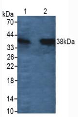 Polyclonal Antibody to Cathepsin L (CTSL)