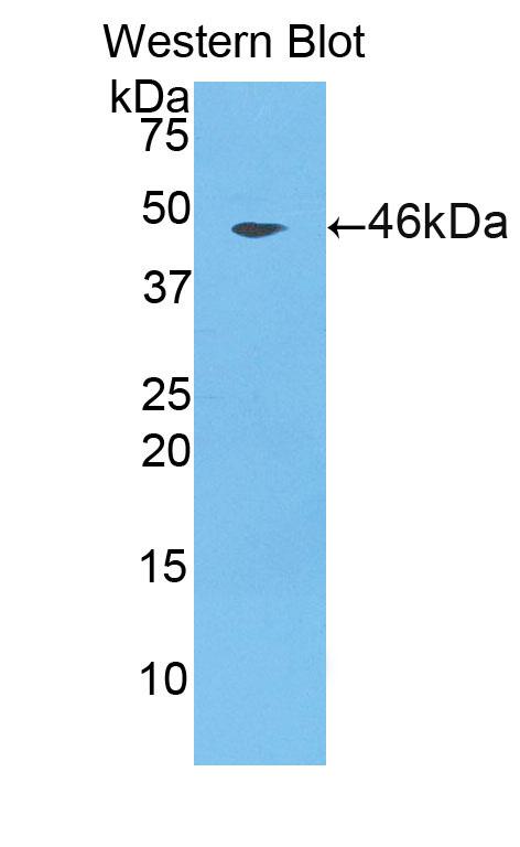 Polyclonal Antibody to Cathepsin L (CTSL)