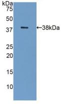 Polyclonal Antibody to Galectin 8 (GAL8)