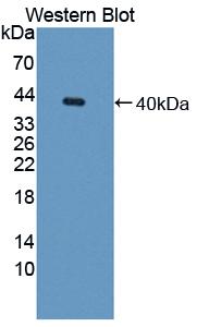 Polyclonal Antibody to Galectin 8 (GAL8)