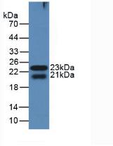 Polyclonal Antibody to Galectin 8 (GAL8)