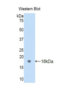 Polyclonal Antibody to Galectin 9 (GAL9)