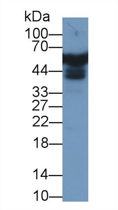 Polyclonal Antibody to Apolipoprotein H (APOH)