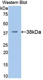 Polyclonal Antibody to Apolipoprotein H (APOH)