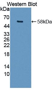 Polyclonal Antibody to Matrix Metalloproteinase 15 (MMP15)