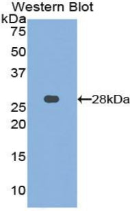 Polyclonal Antibody to Matrix Metalloproteinase 15 (MMP15)