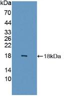 Polyclonal Antibody to Fatty Acid Binding Protein 6, Ileal (FABP6)