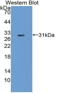 Polyclonal Antibody to Fibroblast Growth Factor 5 (FGF5)