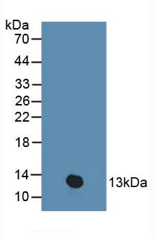 Polyclonal Antibody to Protein Kinase Inhibitor Beta (PKIb)