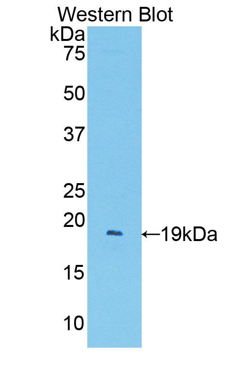 Polyclonal Antibody to Platelet/Endothelial Cell Adhesion Molecule (PECAM1)