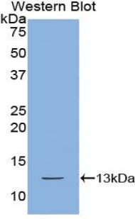 Polyclonal Antibody to Interferon Gamma Induced Protein 10kDa (IP10)