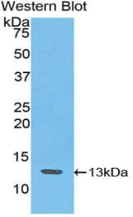 Polyclonal Antibody to Interferon Gamma Induced Protein 10kDa (IP10)