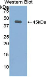 Polyclonal Antibody to Gelsolin (GSN)