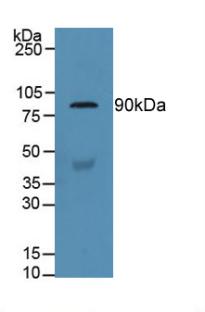 Polyclonal Antibody to Gelsolin (GSN)