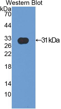 Polyclonal Antibody to Actinin Alpha 2 (ACTN2)