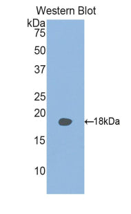 Polyclonal Antibody to Retinol Binding Protein 2, Cellular (RBP2)