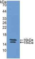 Polyclonal Antibody to Vasoactive Intestinal Peptide (VIP)