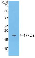 Polyclonal Antibody to Vasoactive Intestinal Peptide (VIP)