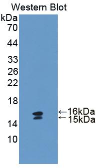 Polyclonal Antibody to Vasoactive Intestinal Peptide (VIP)