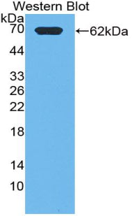 Polyclonal Antibody to Phosphoinositide-3-Kinase Class-2-Alpha Polypeptide (PIK3C2a)