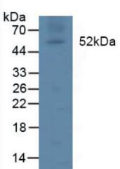 Polyclonal Antibody to Lipoprotein lipase (LPL)