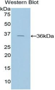 Polyclonal Antibody to Tissue Factor Pathway Inhibitor (TFPI)